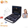Factory price newest ultrasound better than intellivue mx40 3D ultrasound