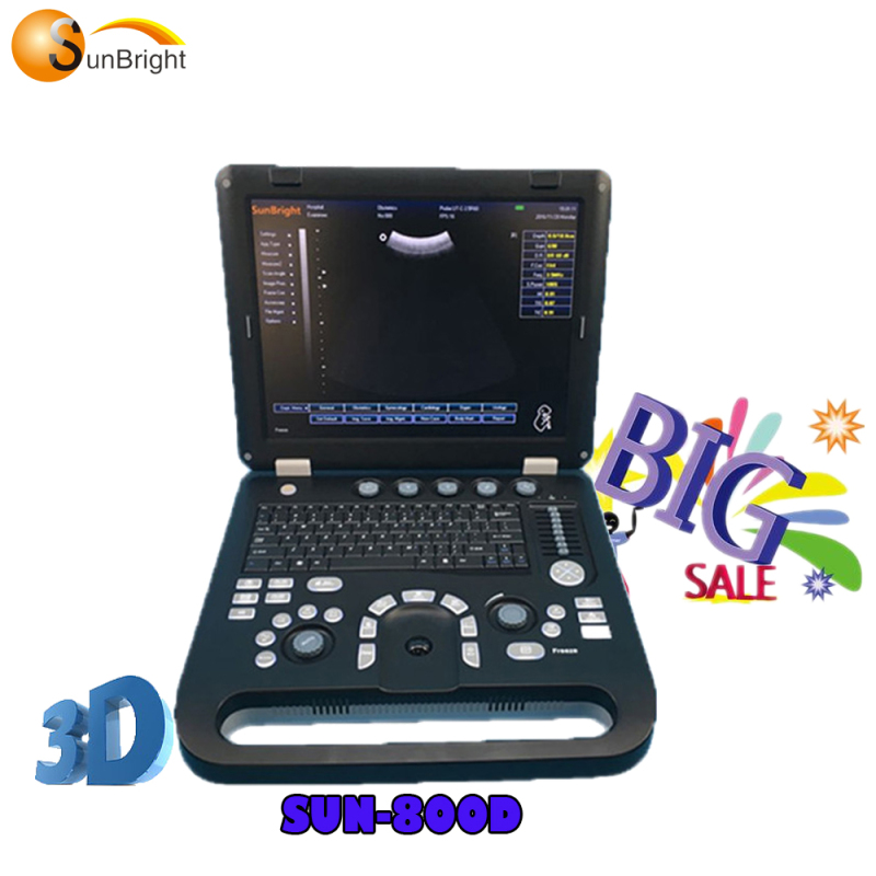 3D Ecograph Laptop Notebook Tragbares Herz-Ultraschallgerät mit Herzsonde