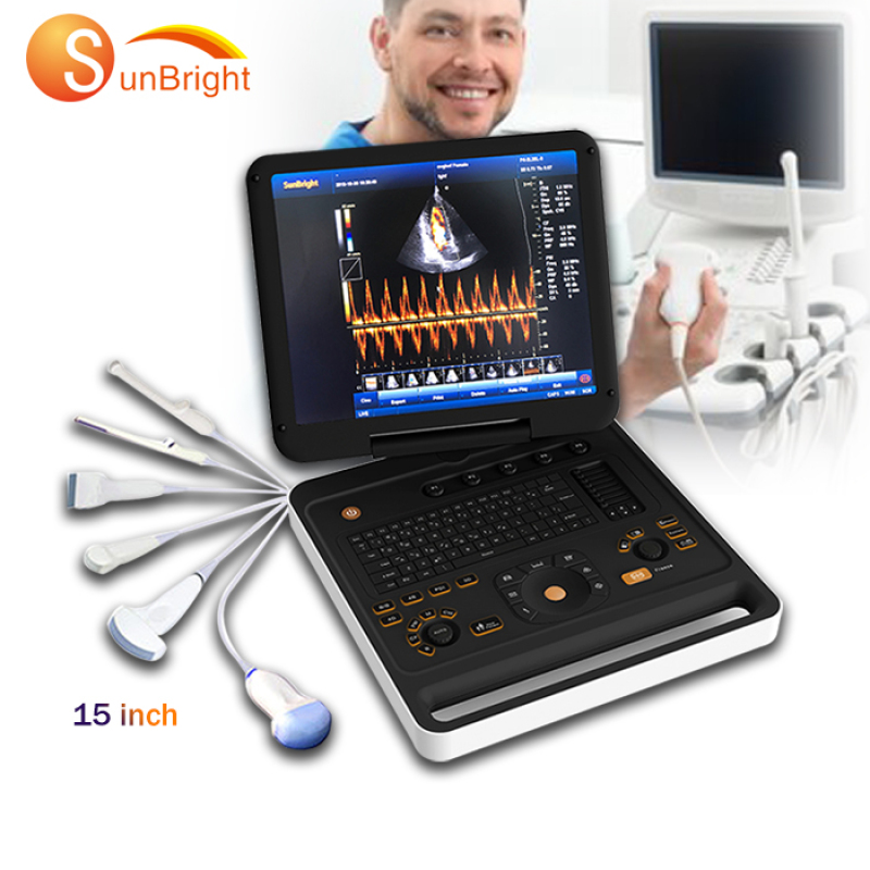 high quality portable laptop medical cardiac ecografo 3D 4D color doppler ultrasound machine