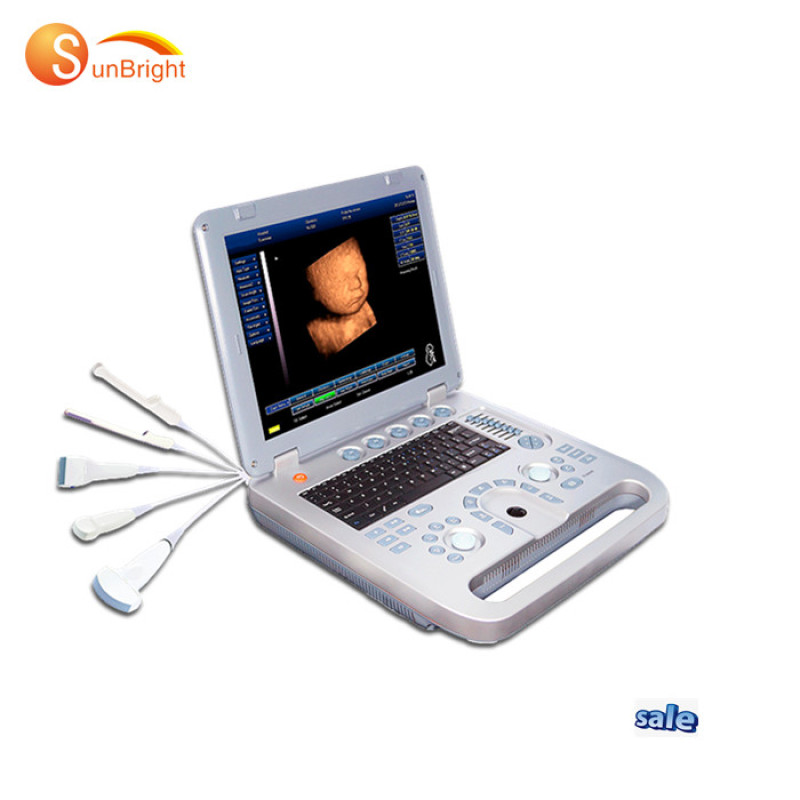 Medical hospital high quality standard digital portable laptop ultrasound scanner machine sonoscape machine