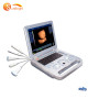 Medical hospital high quality standard digital portable laptop ultrasound scanner machine sonoscape machine