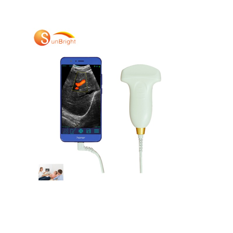 Cardiac 4D Echocardiography Echo Machine color doppler probe ultrasound wireless with Convex Probe