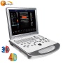 Hospital 3D 4D laptop color doppler ultrasound SUN-906S