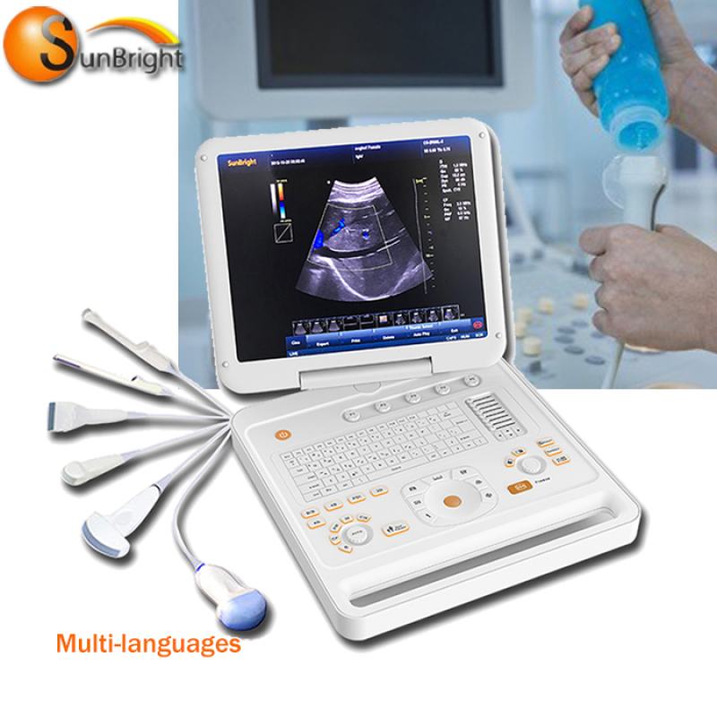 New Style Hot Sale Portable 3D Color Doppler china ultrasonic equipment