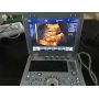 portable laptop ultrasound scanner linear/convex PC platform ultrasound scanning system