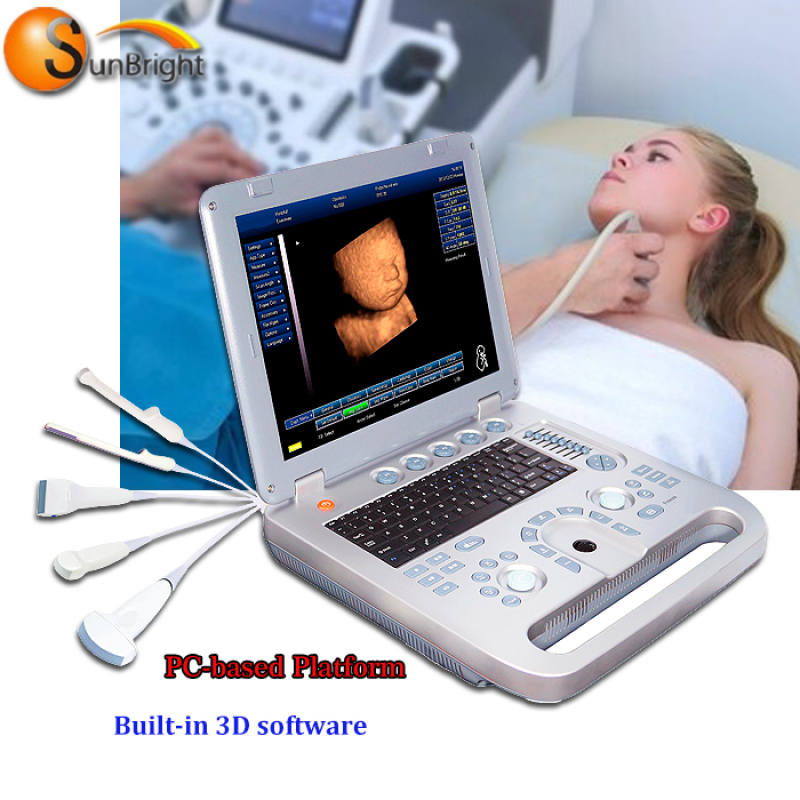 Easy Scan портативний ультразвуковий висококласний лікарняний 3D-сканер