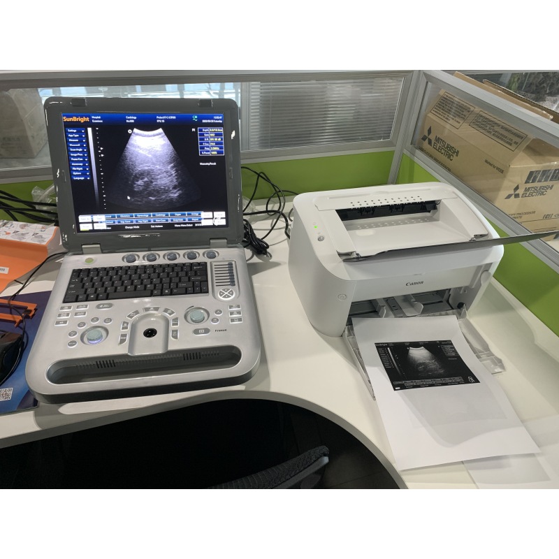 laptop 15 inches ultrasound diagnostic system machine 3d ultrasound machine cost