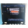 Win7 PC platform laptop doppler ultrasound 3d gynecologic / pregnancy  doppler ultrasound