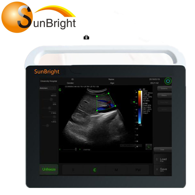 CE approved Optional Colour Doppler 2D Portable 15 inches ultrasonido