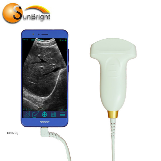 128 Elements wireless Wi-Fi ultrasound 3D USG Ultrasound Probe IOS Android Mobile Device