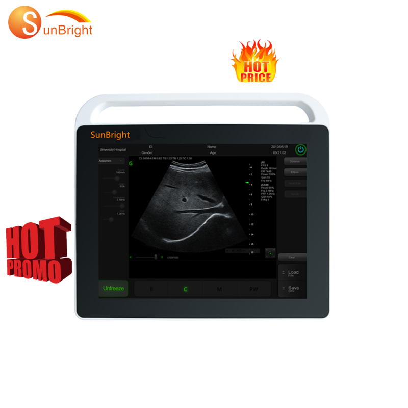 جهاز لوحي Ecograph الطبي المحمول ذو الأسعار المعقولة باللونين الأبيض والأسود