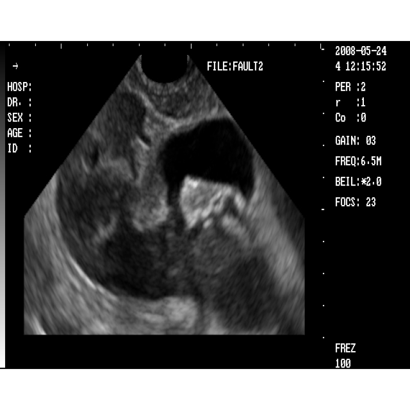 High image quality mini laptop ultrasound machine pocket size convenient for user