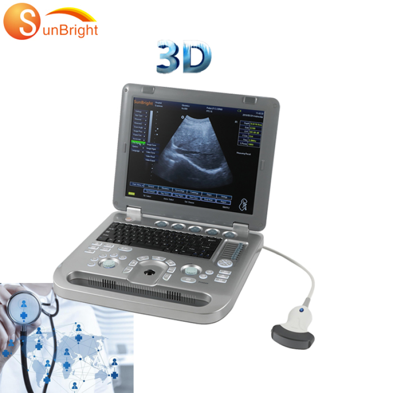 Heißer Verkauf der hochwertigen OB medizinischen 3D-Ultraschallmaschine