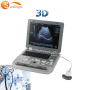 Heißer Verkauf der hochwertigen OB medizinischen 3D-Ultraschallmaschine