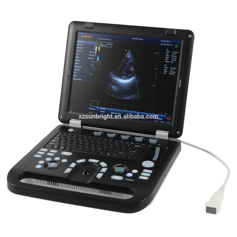 sale 4D doppler ultrasound machine price for pregnancy ultrasonic scanner