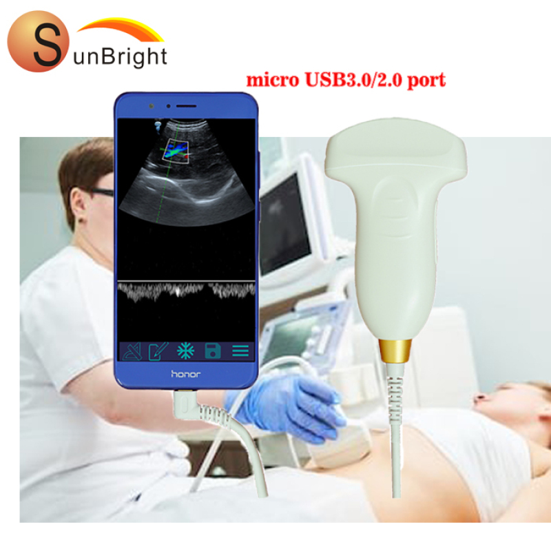 IPhone/Android connect wireless pw veterinary Convex linear high clear image color doppler probe application ultrasound USB