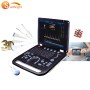 Hospital 3D cardiac probe_ color_ doppler_ ultrasound scanner
