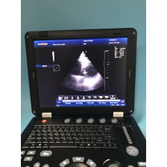 Updated cardiac portable color doppler ultrasound machine price medical sonar portable With Best Price