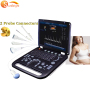 Portable CE color doppler ultrasound machine 3D color doppler for baby/pregnant lower price