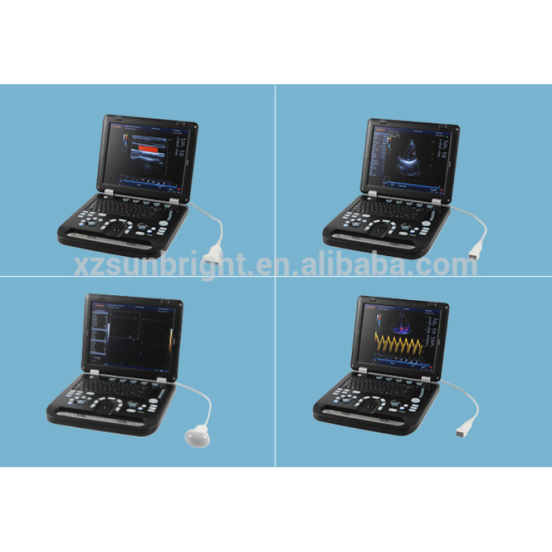 128 elements good quality color doppler ultrasound facotry sale 4D color doppler ultrasound instrument equipment