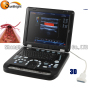 Hospital baby ultrasound machine 3d 4d color Doppler ultrasound device