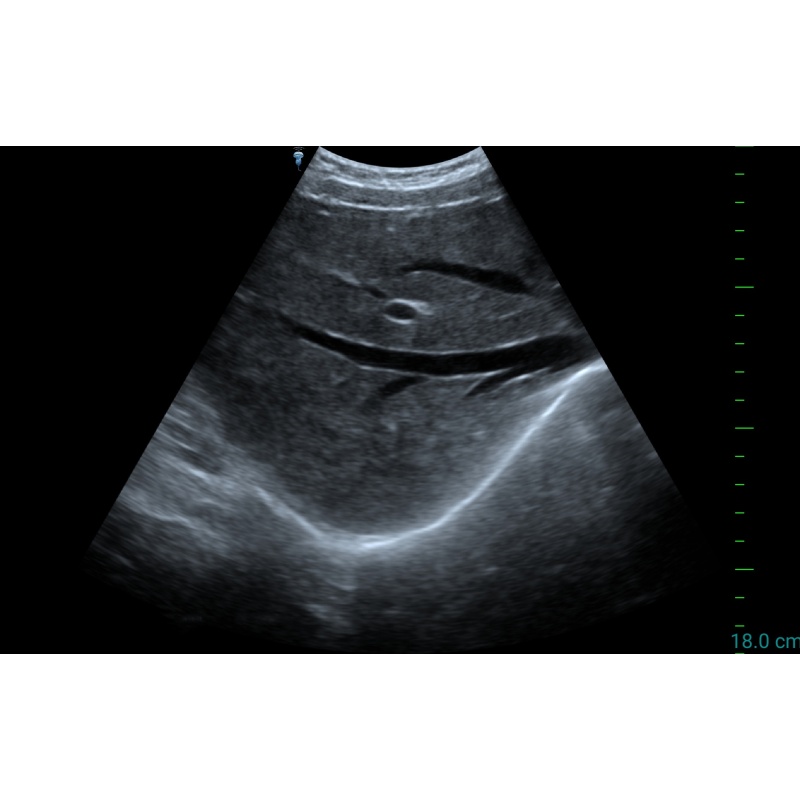Sonda usb convexa wifi ultrasónica vascular portátil médica de alto rendimiento Sun P1