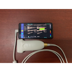 128 elements Color Doppler USB Type-C interface linear ultrasound probe