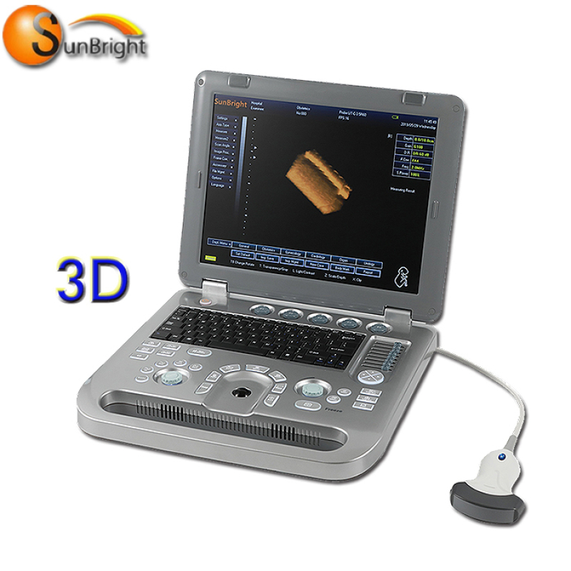 수의학 사용 초음파 진료소 임신 테스트 초음파 기계 초음파