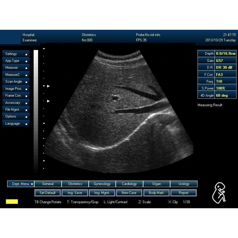 PC 시스템 3D 이미지 초음파 의료 스캐너 sunbright usg