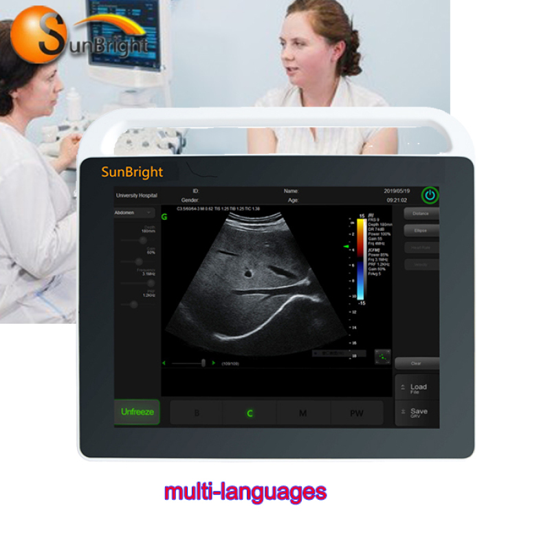Sales portable pregnancy ultrasound scanner SUN-800S