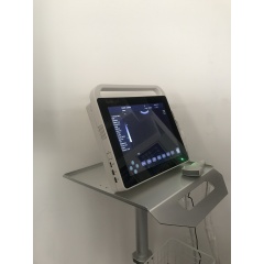 100% quality guaranteed Portable Ultrasound USG touch screen ultrasound ecografo portatil