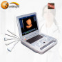 ultrasuono 3D per laptop wireless usg con sonda convessa
