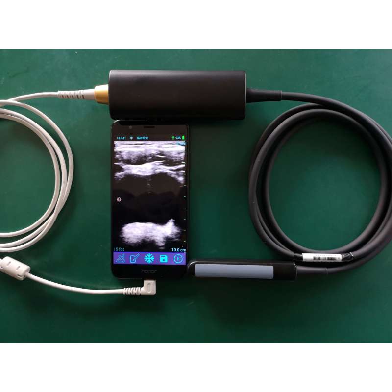 High quality portable Type-C USB rectal ultrasound probe