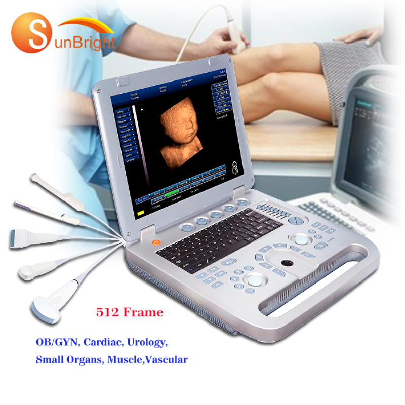 Drei Sonden medizinischer Laptop billiges Licht 15 Zoll großer Speicher Ultraschallscanner 3D ecografo