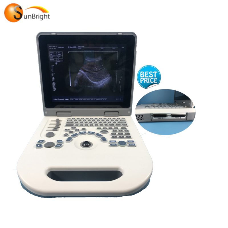 Best Warranty Ultrasound Machine Portable Notebook OB GYN Ultrasound Scanner