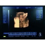 high end laptop medical hospital ob gyn 3d ultrasound machine price