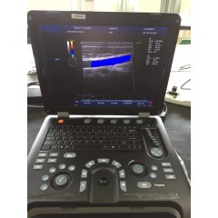 15 inch cardiac portable color Doppler ultrasound
