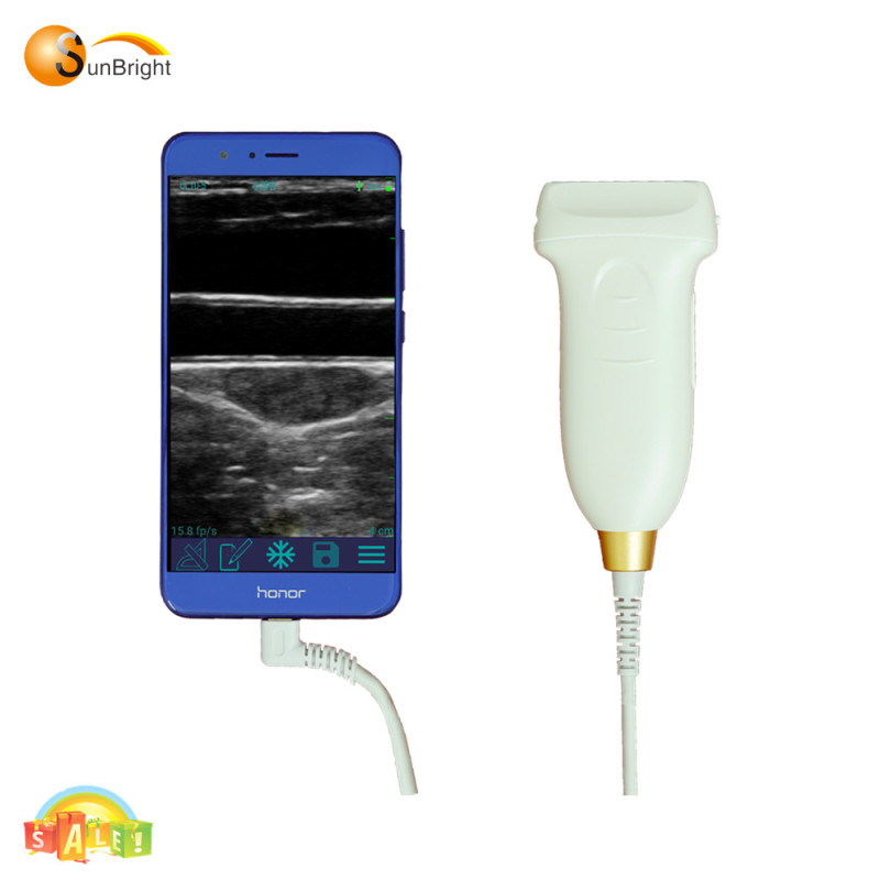 Portable b/w 2d usb linear probe ultrasound diagnosis system new arrived portable ultrasound probe SUN-P2