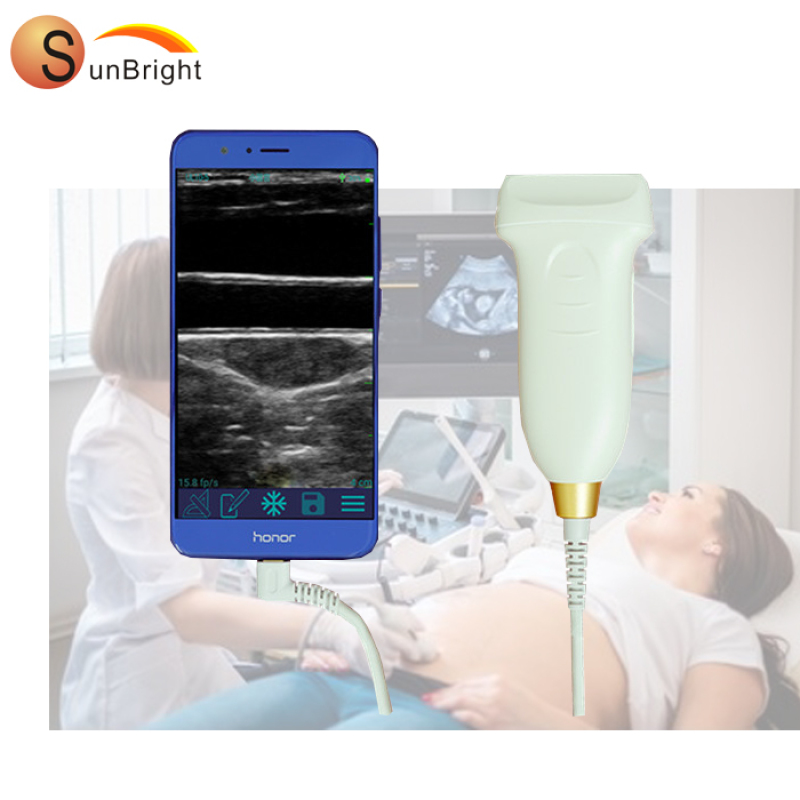 new USB wireless linear probe Medical ultrasound machine B W MINI laptop ultrasound diagnostic