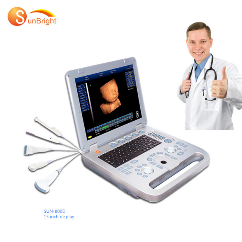 Laptop 15 inch LED good price portable ultrasound 3d cheap ultrasound with cardiac probe