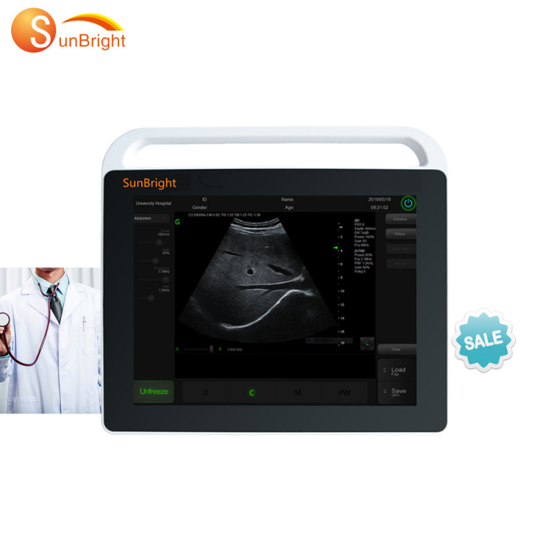 Costo de la máquina de ultrasonido médico con pantalla táctil de alto rendimiento