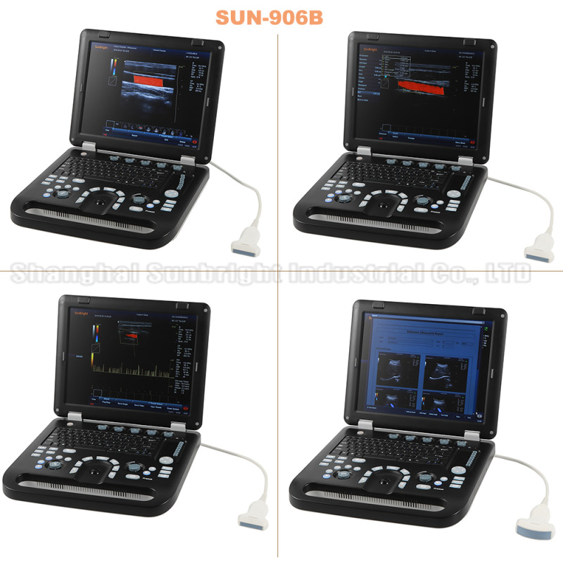 SUN-906A رخيصة كمبيوتر محمول محمول CW PW اللون الماسح الضوئي بالموجات فوق الصوتية دوبلر