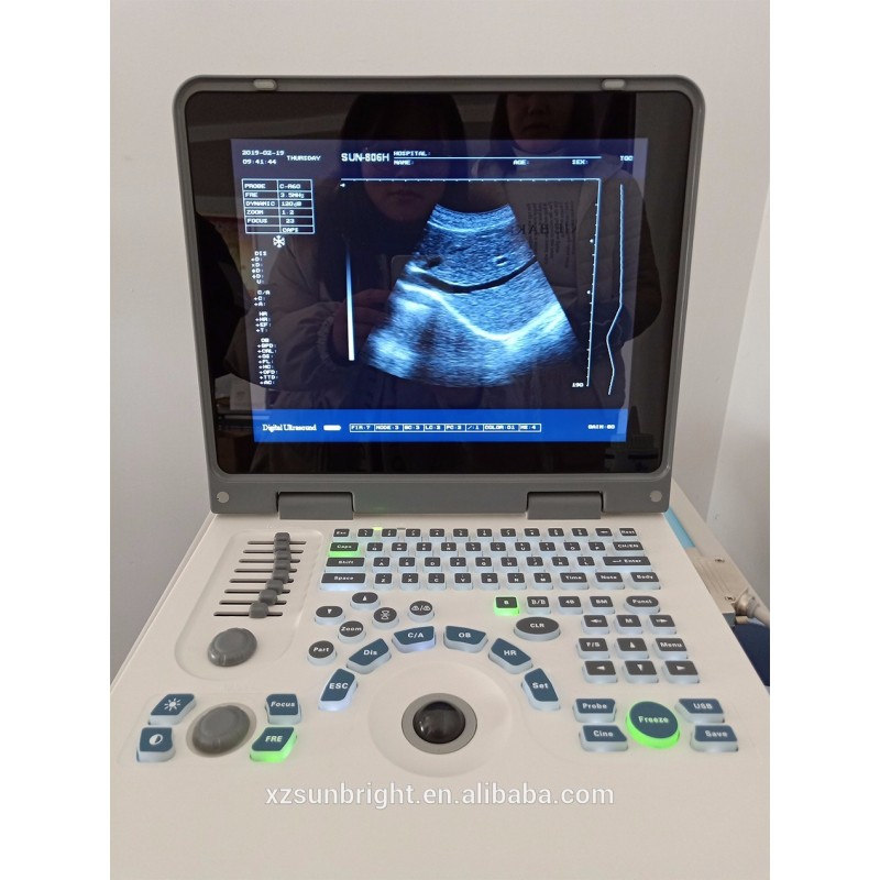 same quality with mindray equipos de ultrasonido portatiles portable echo ultrasound equipment