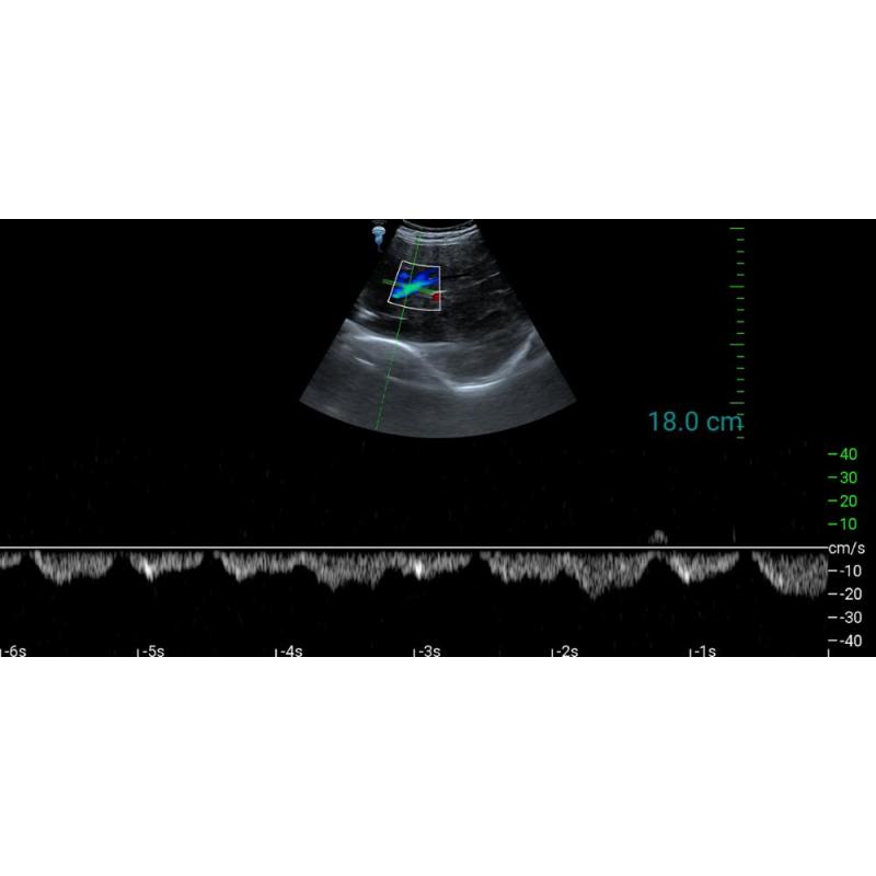 Medical equipment Type C USB ultrasound convex probe