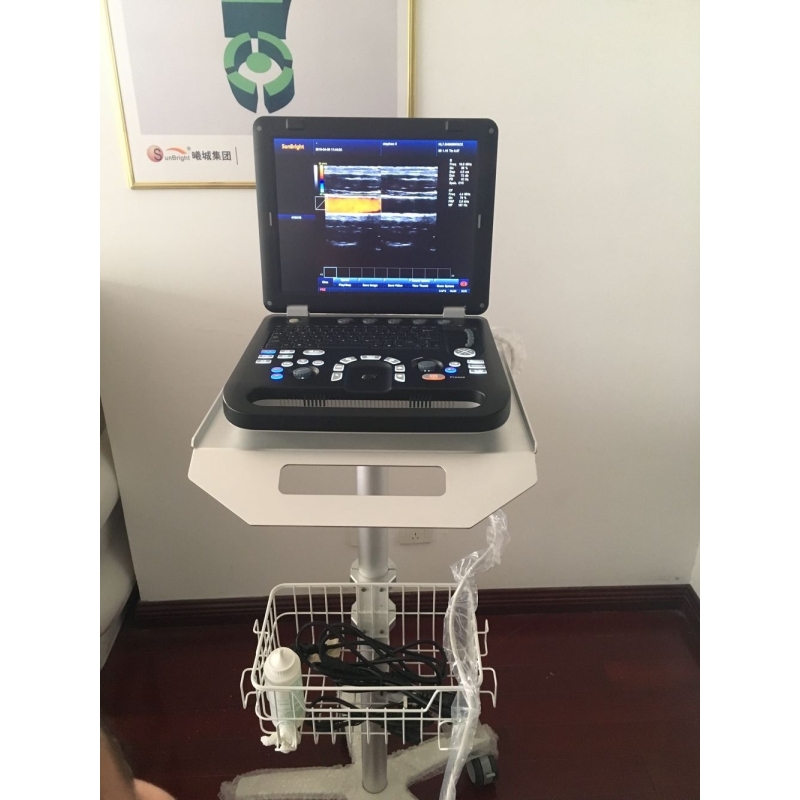 Similar or better than sonoscape ultrasound portable cheap 3D color Doppler device