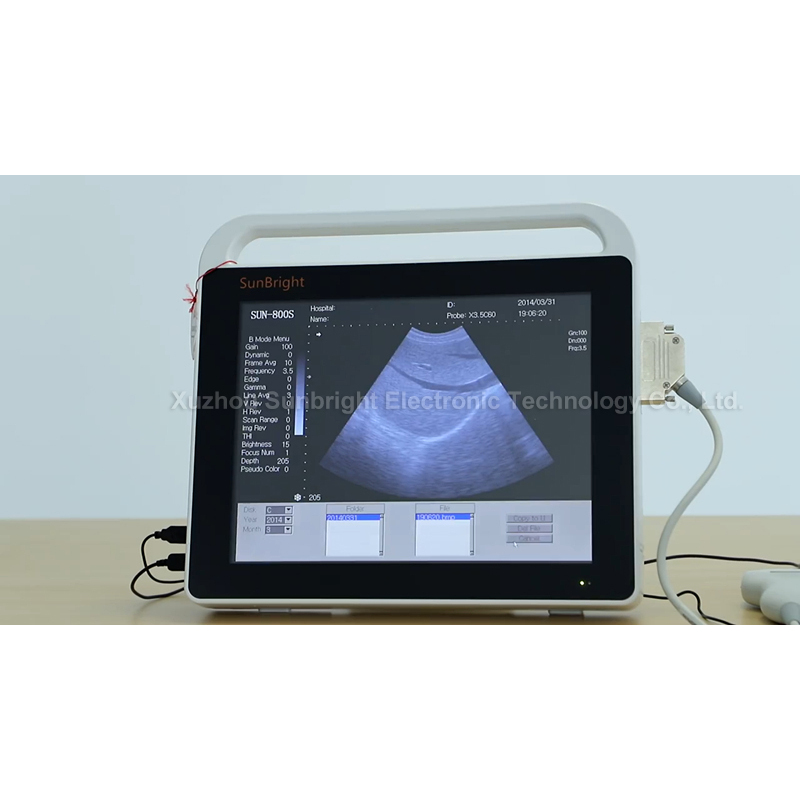 수의학 초음파 스캔 수의사 15 인치 터치 스크린 수의사 초음파 기계 SUN-800S