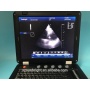 Home hospital use easy to carry portable color Doppler ultrasound device SUN-906C CW Doppler