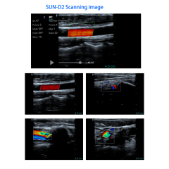 Wireless Handheld Ultrasound linear Probe USB Ultrasound Probe for vascular diagnosis