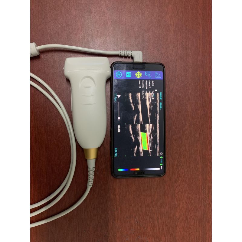 اختبار Sunbright للأوعية الدموية 128 عنصرًا الموجات فوق الصوتية دوبلر ملون USB مسبار