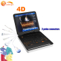 Ecografía Doppler color 3D y 4D SUN-906B, equipo portátil para obstetricia y ginecología